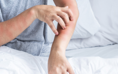 Limpieza profunda de colchones y textiles: adiós a los ácaros en casa